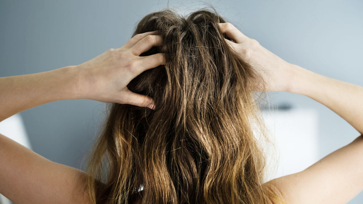 « Depuis que j’utilise cet ingrédient naturel, mes démangeaisons de cuir chevelu ont enfin disparu »